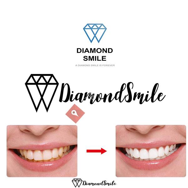 Diamond Smile